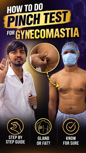 How to Do the Pinch Test for Gynecomastia? | Gland vs Chest Fat Explained