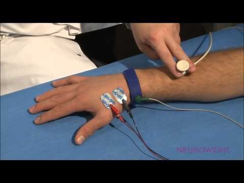 Sensory Neurography - Radial Nerve