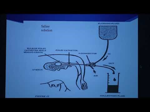 Bovine Embryo Transfer Facts-2 (Conventional Flush Method)