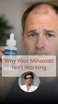 Does Minoxidil Work? Truth About Minoxidil Tolerance Explained | Dr Shail | Satya Skin & Hair Clinic