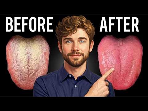 Get Rid of Candida in 24 Hours… Here’s What Actually Works