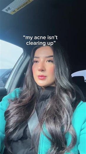 Daily Habits for Acne Clearing Success