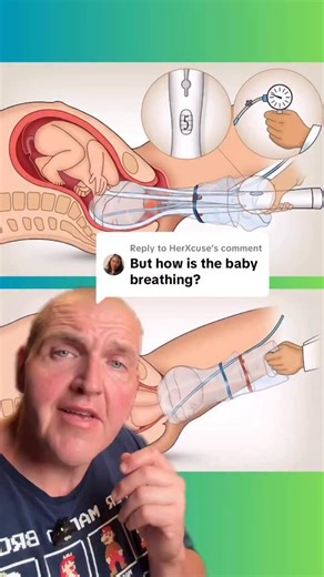 How is that baby breathing with a bag over its head? Luckily, it’s still the corded model and the placenta is doing all the work. #anatomy #science #medical | SCI Body Therapy