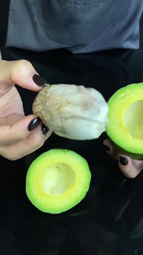 Avocado-Trick gegen Gelenkschmerzen enthüllt