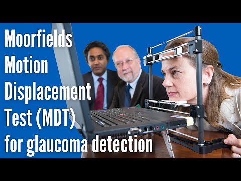 Moorfields Motion Displacement Test (MDT) for Glaucoma Detection