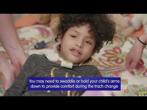 Routine Tracheostomy Tube Changes