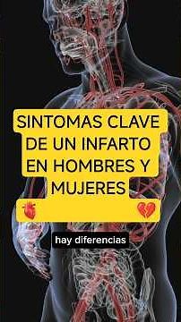 SINTOMAS PARA DETECTAR UN INFARTO EN HOMBRE Y MUJERES