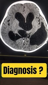 Post Surgery | Brain Scan #medicos1k86 #radiology #brain #scan #ct #radiography #shorts #trending