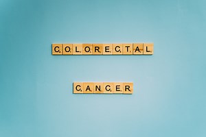 A New Immunotherapy Approach for Advanced Colorectal Cancer | Cancer