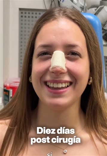 Rinoplastía: Calma la ansiedad postoperatoria