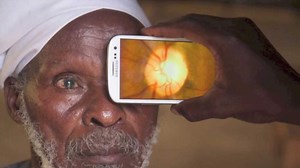 The 'Staggeringly Simple' Eye App