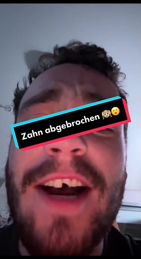 Was tun, wenn ein Zahn abgebrochen ist? Tipps vom Zahnarzt