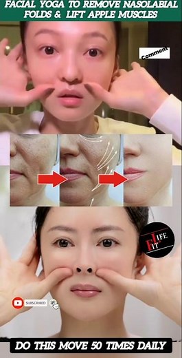 Facial Yoga To Remove Nasolabial Folds & Lift Apple Muscles 😱 #yoga #faceyoga #skincare #shorts