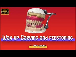 Wax-Up & Carving — My Favorite Part of Dental Lab Work