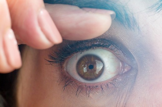 Miosis: definition, symptoms, diagnosis and treatment