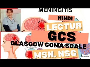 Glasgow Coma Scale (GCS) Explained | Full Lecture with Examples for Nurses & Medical Students