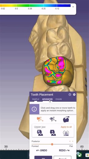 Mohamed shehab on Instagram: "Exocad tips👌😉#exocad #dentaltechnician #dental_student #dentallaboratrory #dentist #dental #explore #explorepage"