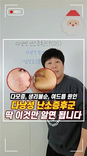 🏫 다낭성 난소증후군 꿀팁 강의[1교시 : 진!짜! 원인]#다낭성 #다낭성난소증후군 #피임약 #다모증 #탈모 #여드름 #생리불순 #혈당 #인슐린저항성
