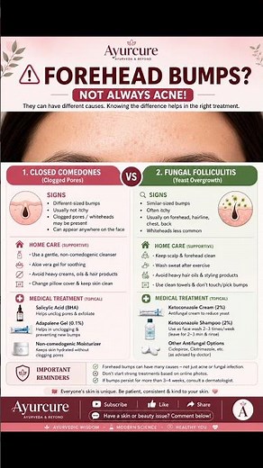 Forehead Bumps? 😱 Not Always Acne! | Closed Comedones vs Fungal Folliculitis Explained
