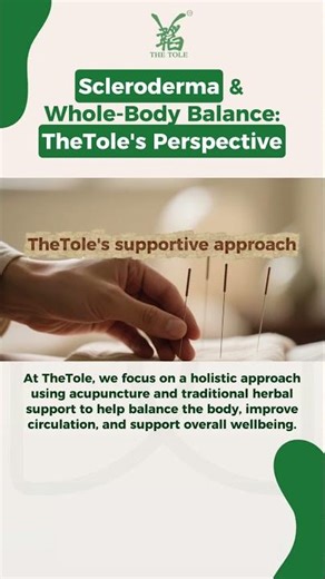 UNDERSTANDING SCLERODERMA - TheTole Acupuncture & TheTole Herbs