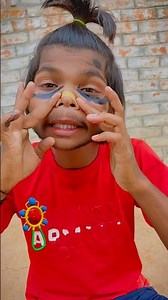 When bache get bandage 🩹😂#comedy #youtubeshorts #trendingshorts #shorts #funny #indian #a9toa9