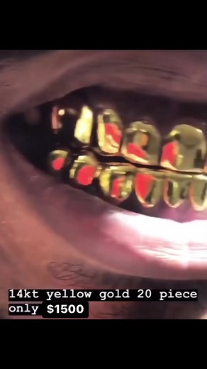 Only $1500 right now for a 14k 20 wall with the permanent cuts! Nobody messing with my prices in Arkansas! Inbox me if you want to get your grill done! 😎💪🏾🔥🔥🔥 | Breon Senior