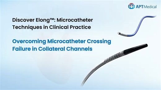 💡 Discover #Elong™ Microcatheter | Overcoming MC Crossing Failure in Collateral Channels Crossing collateral channels in complex CTO PCI can be challenging due to tortuous vessels, acute entry/exit angles, or limited support. This video highlights strategies to overcome failure: microcatheter switching, optimized guide support, balloon anchoring / small-balloon dilation, combined approaches, or exploring alternative channels. The Elong™ Microcatheter enhances every step with excellent trackabil