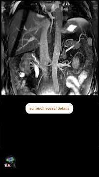 MRI non CONTRAST ENHANCED ABDOMEN