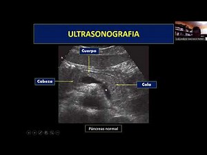 Diagnóstico por Imágenes Clase 22: Pancreatitis Aguda por Ultrasonido y Tomografía (07-03)