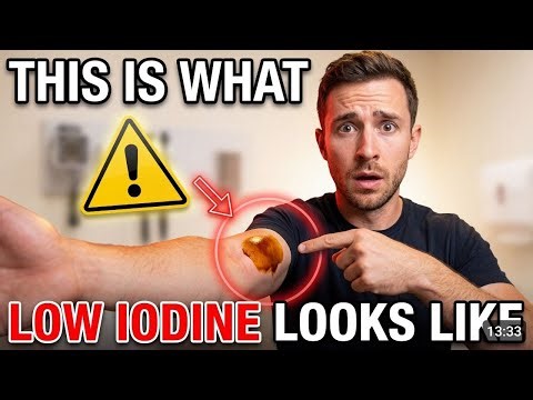 9 Major Signs Iodine Deficiency Is Ruining Your Health!