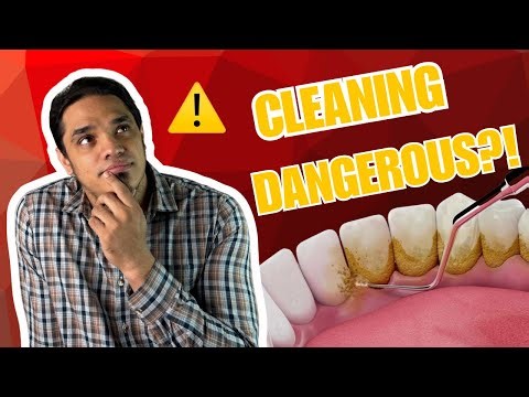 Does Teeth Scaling Weaken Teeth? (5 Myths Busted!)