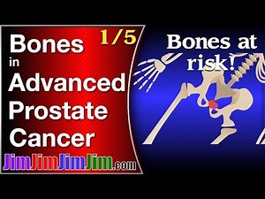 Advanced prostate cancer: Bones at risk!