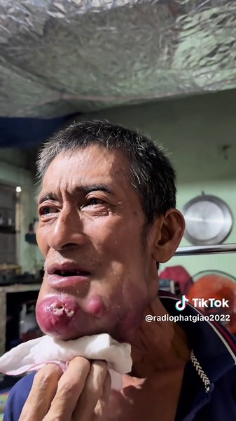 Chú Nam: Chuyện về nỗi đau và sức mạnh trong cuộc sống