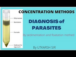 SEDIMENTATION & FLOATATION \\\\CONCENTRATION METHODS FOR PARASITIC DIAGNOSIS. .#pathology #microbio