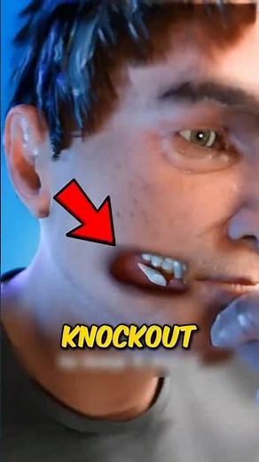 👉 Knocked-Out Tooth? Do THIS in 60 Minutes to Save It! 😳🦷