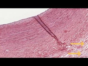 The Macrophage and Fibroblast