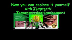 Temptooth temporary tooth replacement for Missing tooth