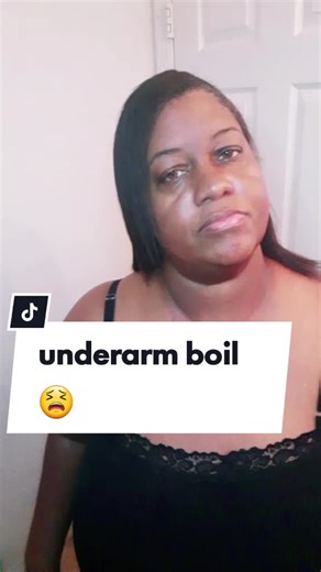 Reply to @sydneymaracle0 Thank you for asking, I hope this helps🙂💚#tampatwin1 #boils #bodyboils #lymphnodes