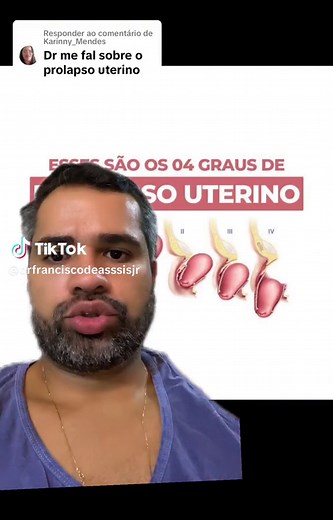 Entendendo o Prolapso Uterino: Causas, Sintomas e Tratamentos