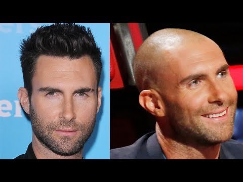 ✅Celebrity Hair Transplant Transformations! Why shaved head doesn´t suit everybody!