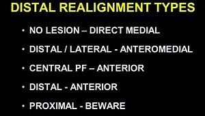 When Do I Add Tubercle Procedures in Patella Instability?