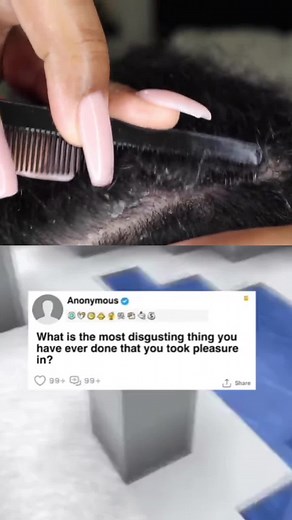 What is the mkst disgusting thing you took pleasure in? #dandruffpicking #foryou #fyp #viral