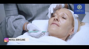 1.9K views · 39 reactions | High intensity focused ultrasound therapy...