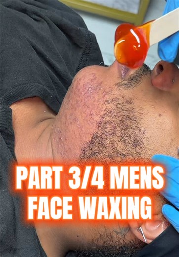 Men's Face Waxing with Turmerika Wax