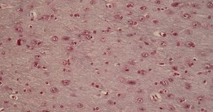 Brain Nerve Cells Under Microscope 200x Stock Footage Video (100% Royalty-free) 3652738571 | Shutterstock