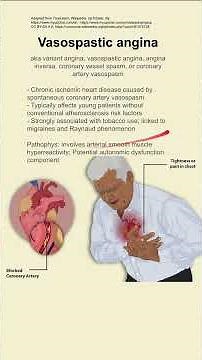 Vasospastic angina