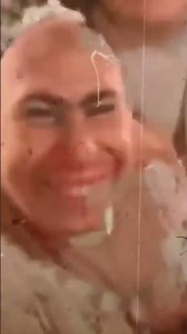 30 Circus Freaks That Actually Existed! Historical Photos