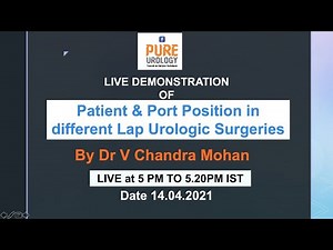 Patient & Port Position in different Lap Urologic Surgeries