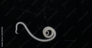 Ascariasis is a disease caused by the parasitic roundworm Ascaris lumbricoides for education in laboratories.