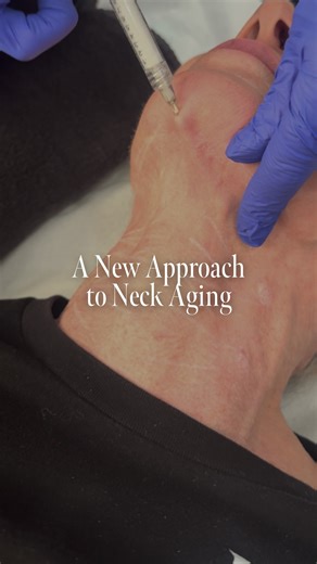 External Affairs Medical Spa Kelowna on Instagram: "Becky’s newest obsession is here 👀 Hyperdilute Radiesse for the neck is a go-to when you’re noticing changes in texture, laxity, or sun damage and want to support your skin’s collagen in a big way. If you’re 40+ and your neck is starting to feel like it’s giving away your secrets, this is your sign to book a consult 🤍 We’ll build the right plan for your skin. #ExternalAffairsSpa #HyperdiluteRadiesse #NeckRejuvenation #CollagenStimulation #Ski